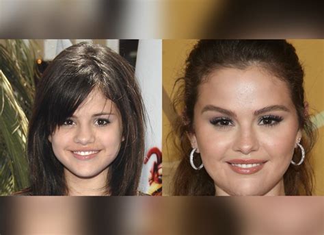 Selena Gomez Opens Up About Cosmetic Surgery & Reacts to。